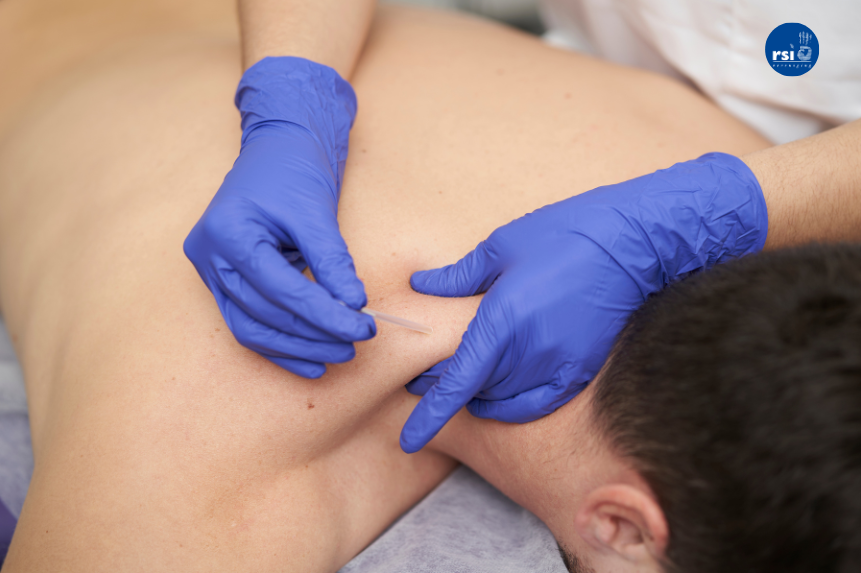 Dry needling: therapeut met blauwe handschoenen aan prikt een naald in de schouder bijeen persoon die op de buik op een behandeltafel ligt.