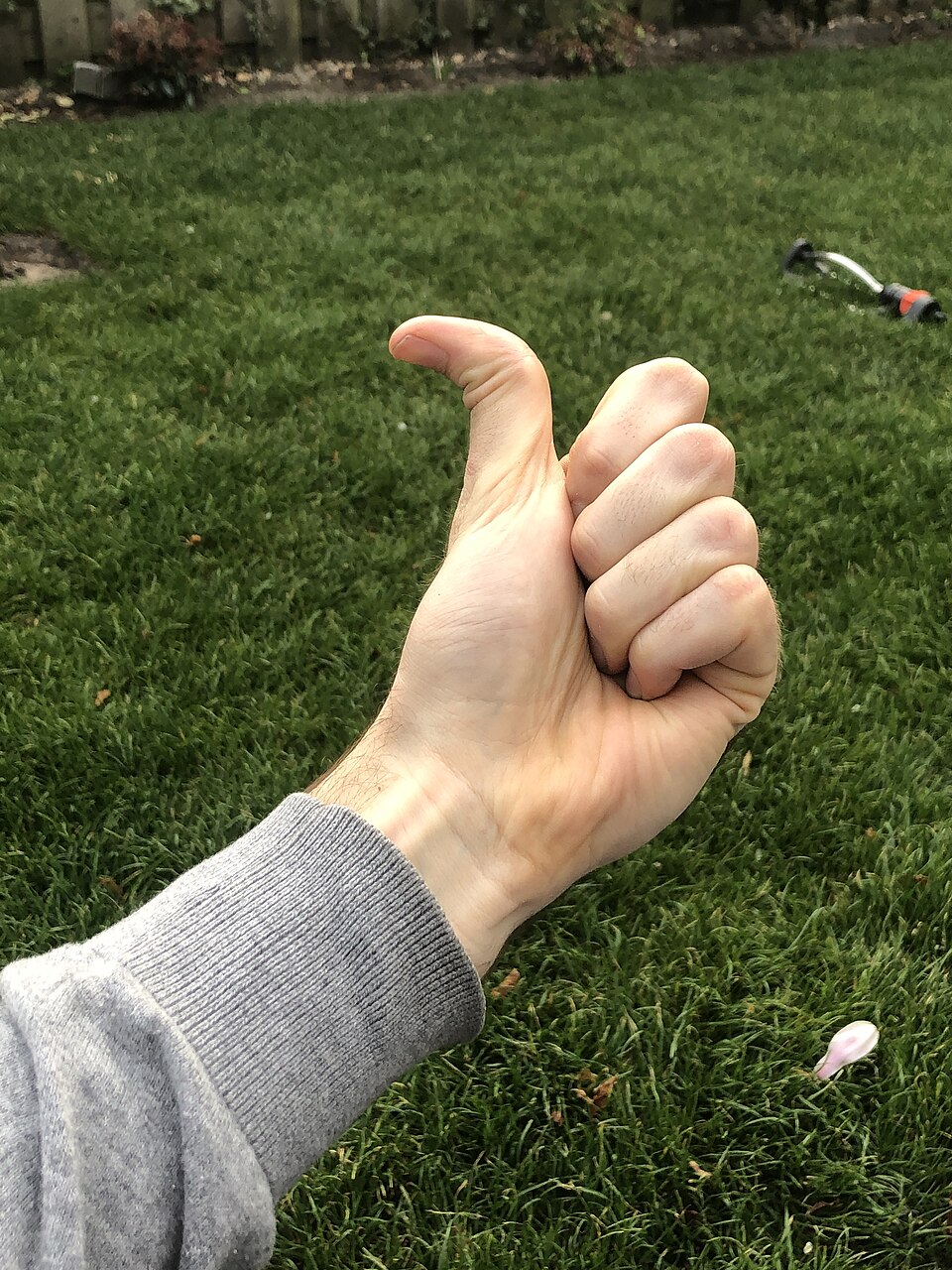 Ehlers-Danlos: een hand met een duim die ver achterover gebogen is. Niet naar de handpalm toe, maar naar buiten toe.